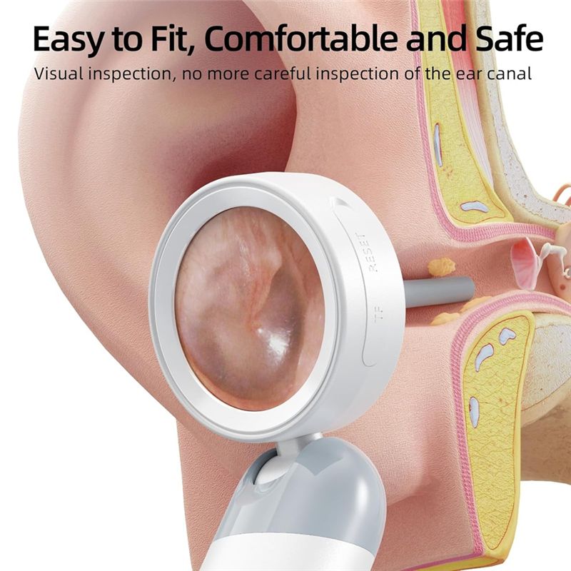 LXYB18B Wireless Ear Otoscope  - Macro Photography Led Lighting 评论和价格