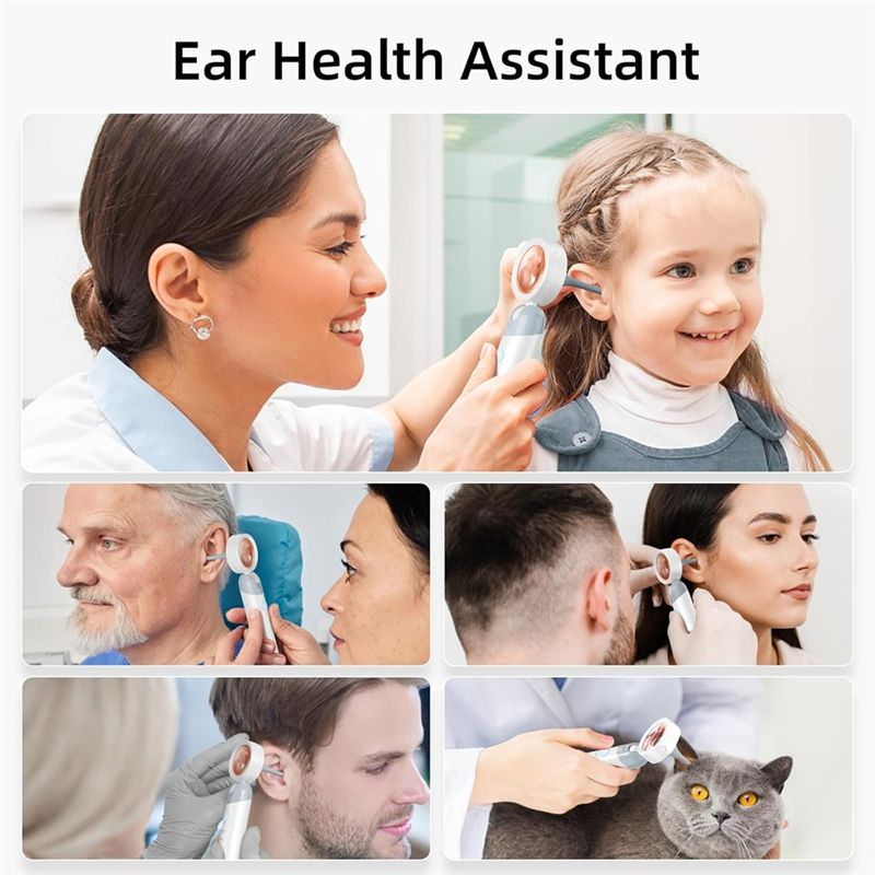 LXYB18B Wireless Ear Otoscope  - Macro Photography Led Lighting 评论和价格