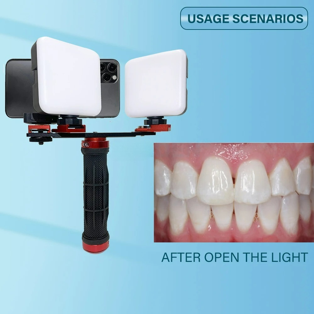 Dental Photography Light Phone - Photography Lighting Accessories 评论和价格