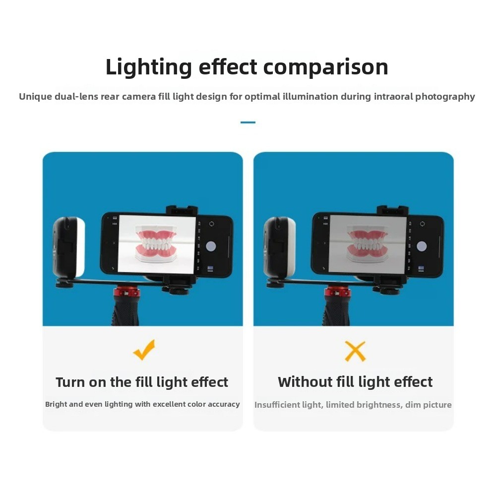 Dental Photography Light, Blue - Photography Video Lighting Kit 评论和价格